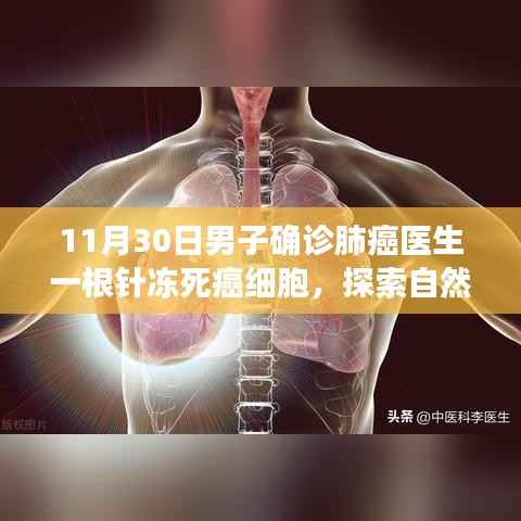 探索自然美景之旅,针冻科技治疗肺癌,心灵宁静与科技共融