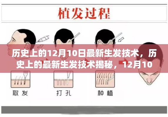 揭秘历史植发技术,从初学者到进阶用户的植发全攻略(12月10日植发技术揭秘)