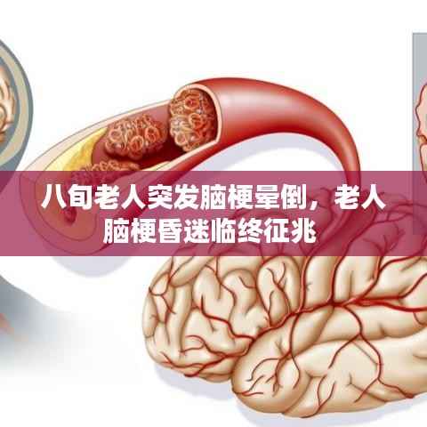 八旬老人突发脑梗晕倒,老人脑梗昏迷临终征兆