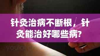 针灸治病不断根,针灸能治好哪些病?