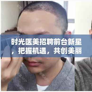 时光医美招聘前台新星,把握机遇,共创美丽新篇章
