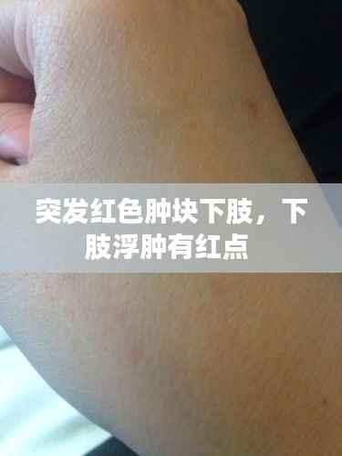 突发红色肿块下肢,下肢浮肿有红点