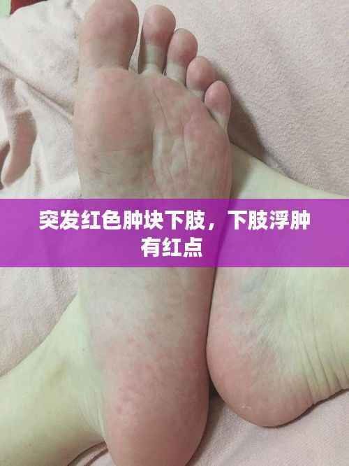 突发红色肿块下肢,下肢浮肿有红点