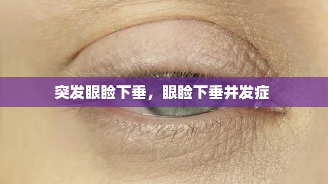 突发眼睑下垂,眼睑下垂并发症