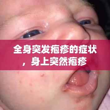 全身突发疱疹的症状,身上突然疱疹